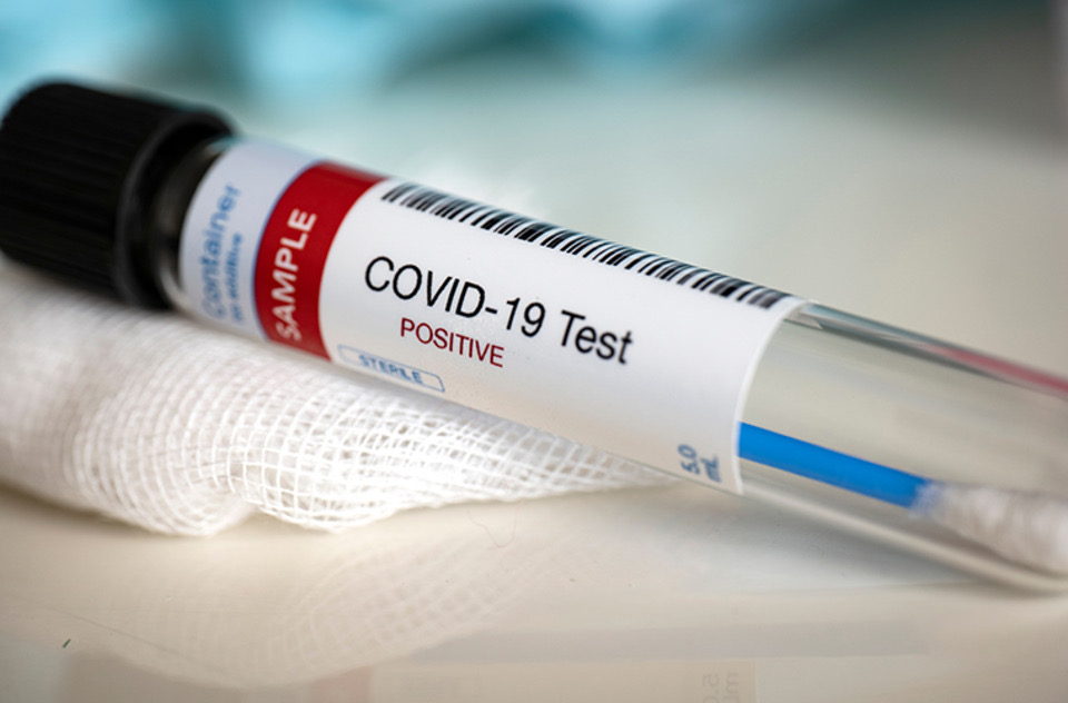 Quinto caso confirmado de coronavirus en Funes