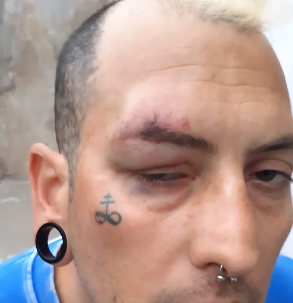 Brutal agresión a un joven con discapacidad en Roldán: el ataque fue filmado y viralizado